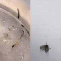 Girl vomits live worms for a month and turns out to be a medical riddle | De Último Minuto English