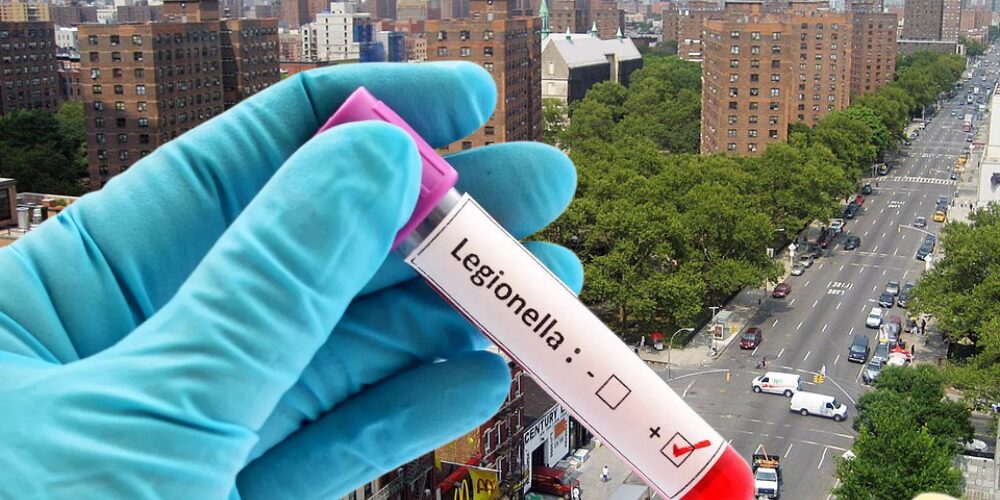 Four people die in New York due to a Legionnaires' disease outbreak | De Último Minuto English