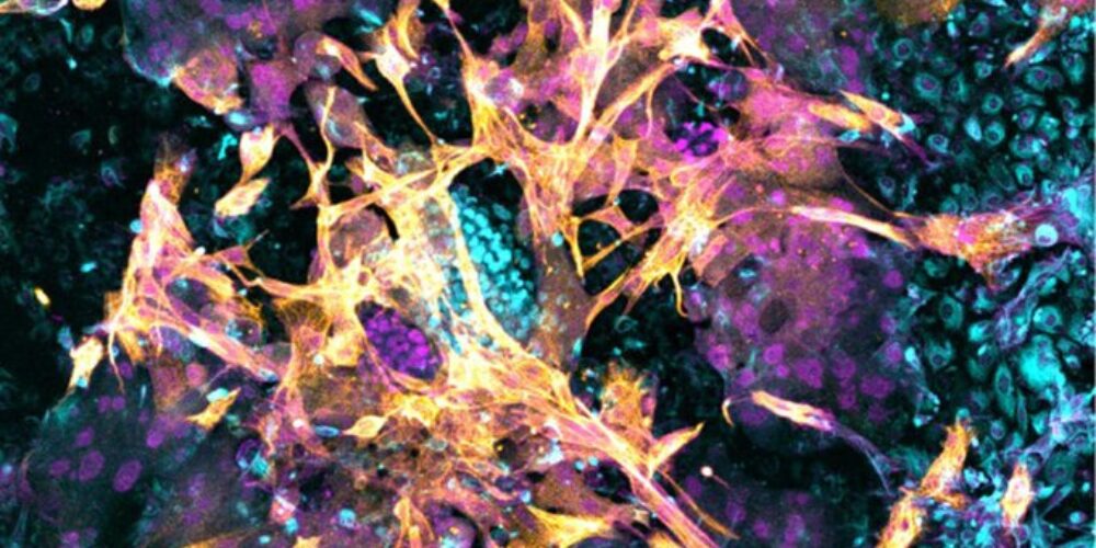 They successfully implant an embryo in an artificial endometrium | De Último Minuto English