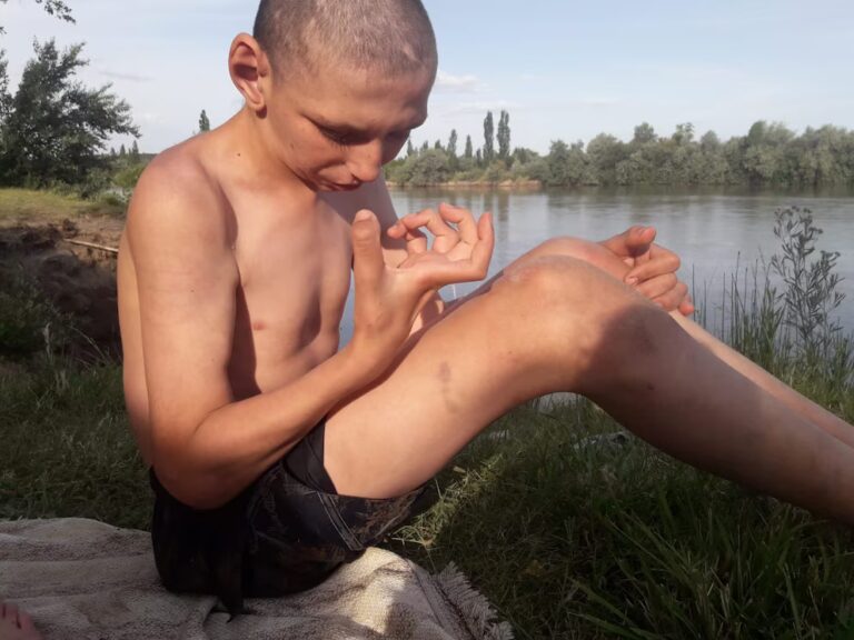 He is 2.30 meters tall and his bones prevent him from walking: the young Patagonian who needs a crane to get out of bed