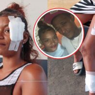 Young woman reports savage machete attack by her ex-partner despite five arrest warrants in Santiago | De Último Minuto English