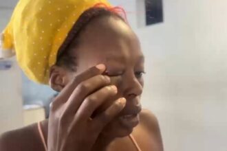 Man assaults his Haitian ex-partner and causes facial injuries in San Francisco de Macorís | De Último Minuto English