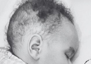 Baby with spinal muscular atrophy who was waiting for access to medication dies | De Último Minuto English