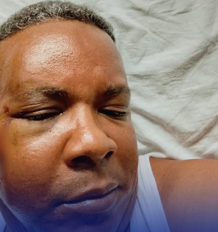 COBA inspector ends up hospitalized after assault during operation for loud music in SDE | De Último Minuto English