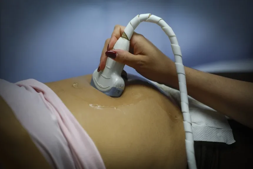 Chilean far-right seeks to force women to hear the fetal heartbeat before having an abortion | De Último Minuto English