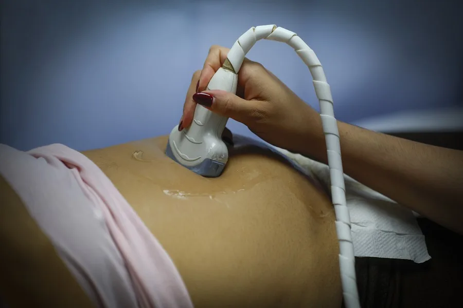 Chilean far-right seeks to force women to hear the fetal heartbeat before having an abortion