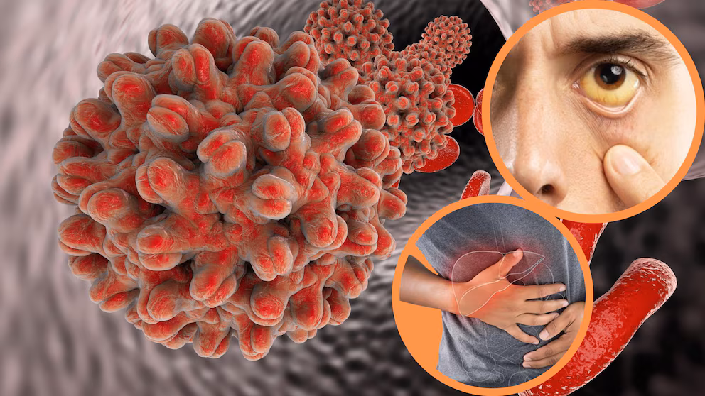 Costa Rica confirms 14 cases of hepatitis A and contamination in water system