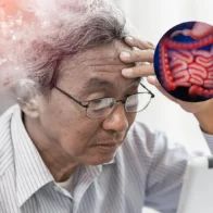 ¿Can the gut influence Alzheimer's? A study seeks the answer | De Último Minuto English