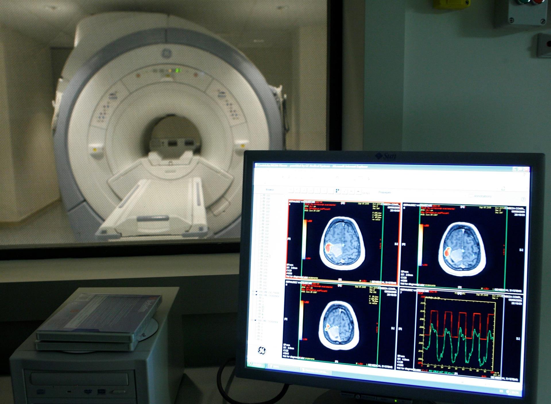 Chilenos proponen un tratamiento contra el alzhéimer con nanopartículas de oro - Noticias de hoy en República Dominicana | De Último Minuto