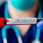 Reportan 713 contagios de covid-19 y nueve defunciones en últimas 24 horas - Noticias de hoy en República Dominicana | De Último Minuto