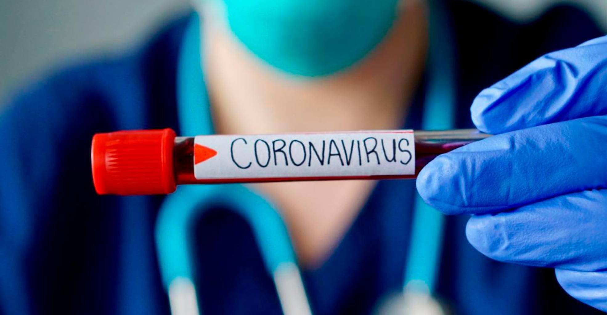 Reportan 713 contagios de covid-19 y nueve defunciones en últimas 24 horas - Noticias de hoy en República Dominicana | De Último Minuto