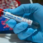 Se registran 362 nuevos casos de covid-19 y ningún fallecimiento - Noticias de hoy en República Dominicana | De Último Minuto