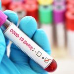Salud Pública notifica 190 casos de covid-19 y 5 fallecimientos - Noticias de hoy en República Dominicana | De Último Minuto