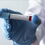 República Dominicana registra 326 nuevos casos de coronavirus y 2 muertes - Noticias de hoy en República Dominicana | De Último Minuto