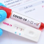 Baja positividad diaria del COVID; reportan dos muertes - Noticias de hoy en República Dominicana | De Último Minuto