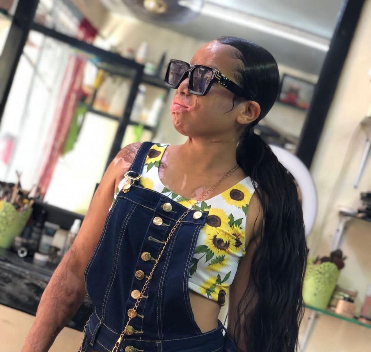 Yocairy Amarante cuenta su historia a un año “del peor día de su vida” - Noticias de hoy en República Dominicana | De Último Minuto