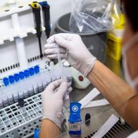 Reportan 253 casos de COVID-19 en RD; ocupación hospitalaria sigue a la baja - Noticias de hoy en República Dominicana | De Último Minuto