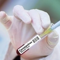 República Dominicana registra nuevo récord de 5,968 casos diarios de covid-19 - Noticias de hoy en República Dominicana | De Último Minuto
