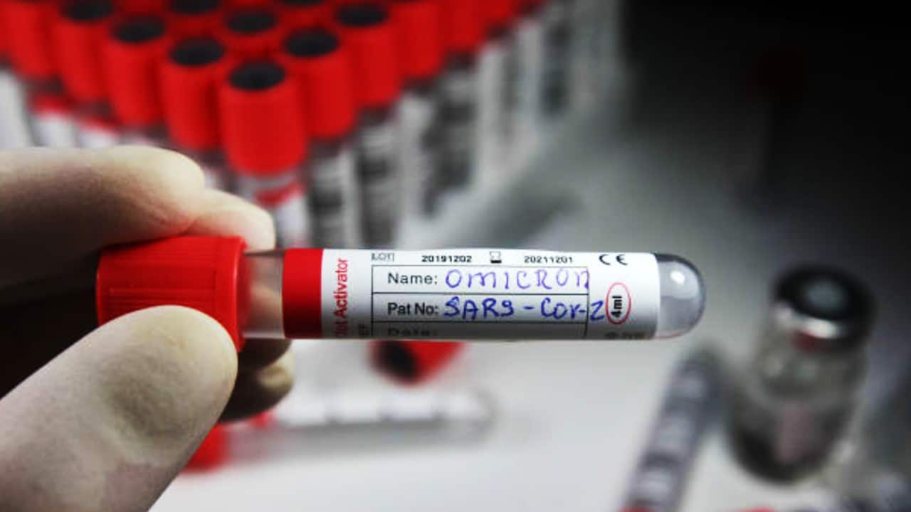 OMS: no es seguro que ómicron caiga en el mundo tan pronto como en Sudáfrica - Noticias de hoy en República Dominicana | De Último Minuto