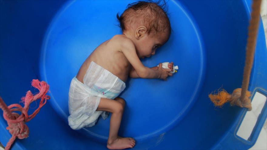 Unicef alerta de crisis de malnutrición infantil por precios de la comida
