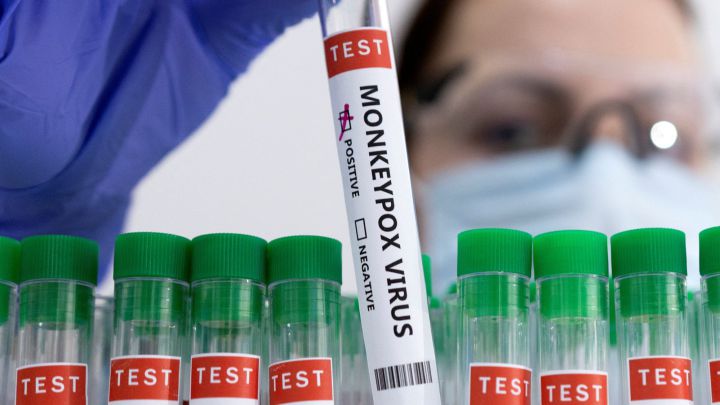 Identificado el primer caso de viruela del mono en Irlanda