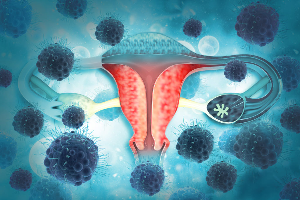 Nuevo test no invasivo avanza un año detección de cáncer de endometrio