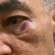 Filtran fotos de los presuntos golpes que recibió Félix Alburquerque a manos de Manuel Duncan - Noticias de hoy en República Dominicana | De Último Minuto