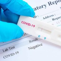 El covid-19 sigue en descenso, Salud Pública notifica 7 casos nuevos - Noticias de hoy en República Dominicana | De Último Minuto
