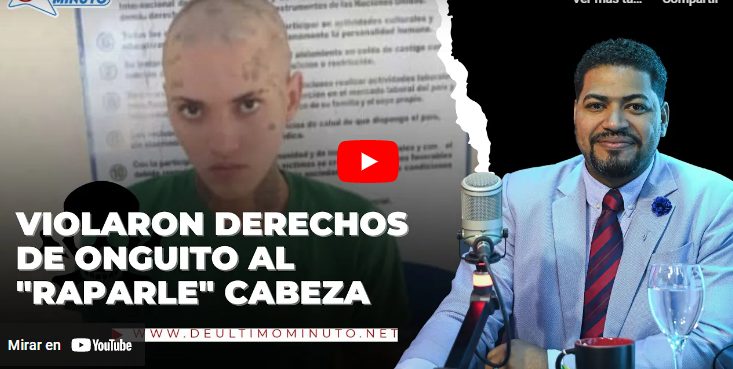 Haberle rapado la cabeza a Onguito Wa viola el debido proceso, según abogado - Noticias de hoy en República Dominicana | De Último Minuto