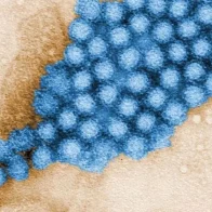 Qué es el norovirus identificado en el brote de gastroenteritis en Florinópolis: síntomas, riesgos y prevención - Noticias de hoy en República Dominicana | De Último Minuto