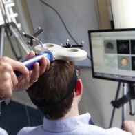 La estimulación magnética transcraneal, un método innovador para personas con depresión - Noticias de hoy en República Dominicana | De Último Minuto
