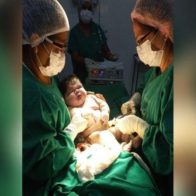 Mujer da a luz un "bebé gigante" de 7,3 kg en Brasil - Noticias de hoy en República Dominicana | De Último Minuto