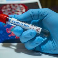 Salud Pública notifica 161 nuevos casos de coronavirus - Noticias de hoy en República Dominicana | De Último Minuto