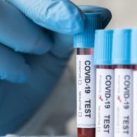 Boletín Covid: 11 nuevos casos y 1 persona hospitalizada - Noticias de hoy en República Dominicana | De Último Minuto