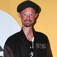 Muere el actor Darren Kent, famoso por la serie 'Juego de Tronos' - Noticias de hoy en República Dominicana | De Último Minuto