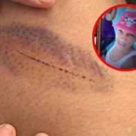 Hombre agrede a niño de 12 años y a su madre, porque el menor le tumbó un motor - Noticias de hoy en República Dominicana | De Último Minuto