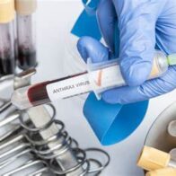 Haití confirma una decena de casos sospechosos de ántrax y adopta medidas - Noticias de hoy en República Dominicana | De Último Minuto