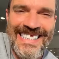 Julián Gil perdió un diente tras su participación en “La isla - Noticias de hoy en República Dominicana | De Último Minuto