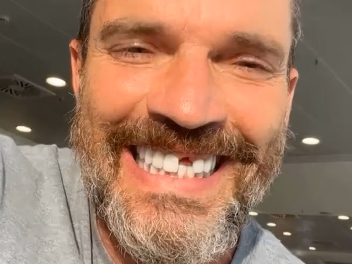 Julián Gil perdió un diente tras su participación en “La isla - Noticias de hoy en República Dominicana | De Último Minuto