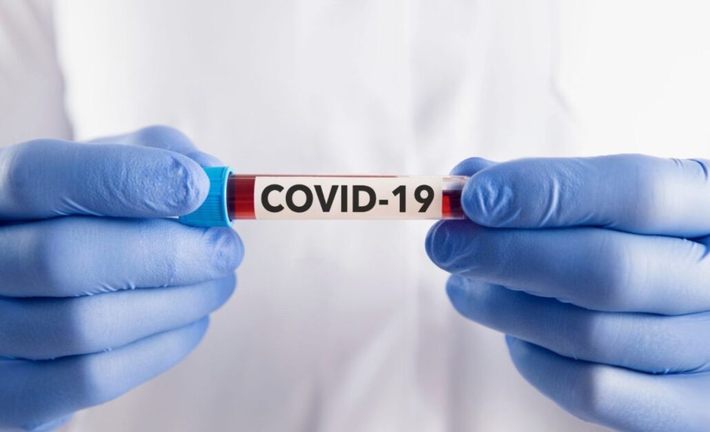 OMS: Covid no se ha ido, como lo muestran al menos 40 infecciones entre atletas olímpicos