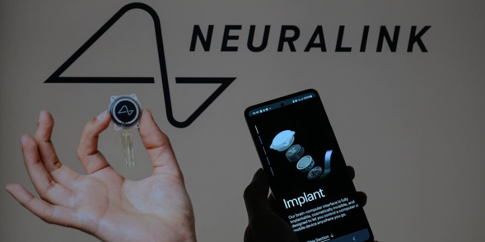 Neuralink recibe la autorización para probar su chip cerebral para mover brazos robóticos