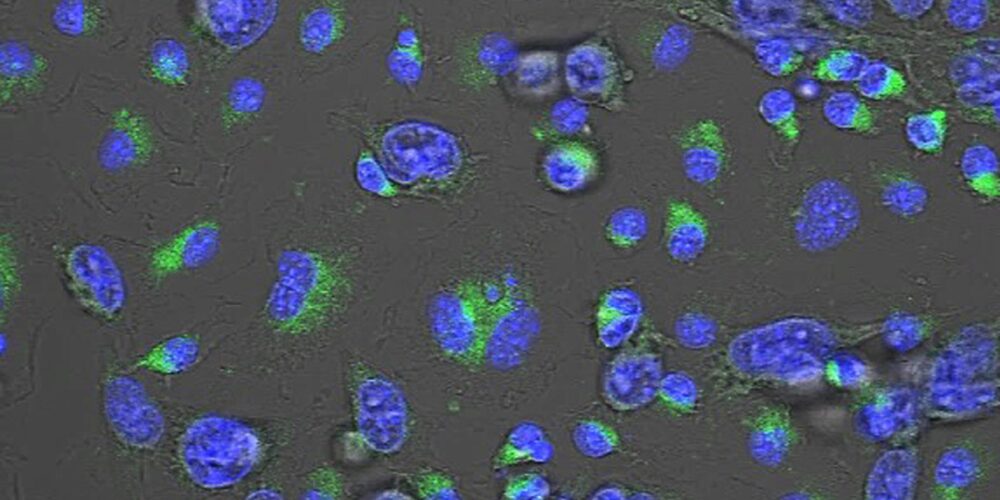 Prueban en ratones un compuesto químico que reduce la metástasis en cáncer de mama