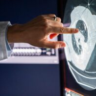 Mass General explica diferencias entre terapia dirigida e inmunoterapia para el cáncer