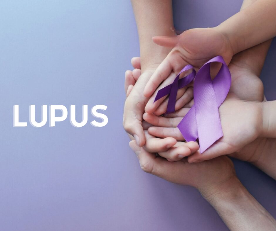 Día Mundial del Lupus: Visibilizando una enfermedad silenciosa y complicada | De Último Minuto