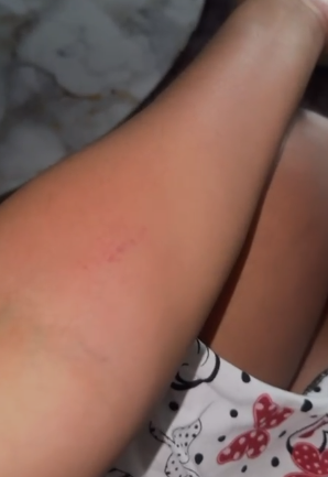 Mujer denuncia fue golpeada e insultada por conductor de Indrive que se negó a llevarla a Los Mina | 2 | Mujer denuncia fue golpeada e insultada por conductor de Indrive que se negó a llevarla a Los Mina - Noticias de hoy en República Dominicana | De Último Minuto