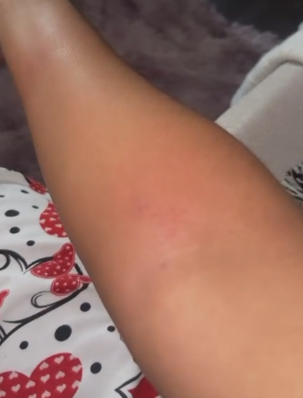 Mujer denuncia fue golpeada e insultada por conductor de Indrive que se negó a llevarla a Los Mina | 3 | Mujer denuncia fue golpeada e insultada por conductor de Indrive que se negó a llevarla a Los Mina - Noticias de hoy en República Dominicana | De Último Minuto