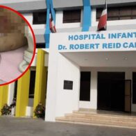 Una bebé de un mes de nacida fue ingresada al hospital por fractura de cráneo; padre denuncia a la madre