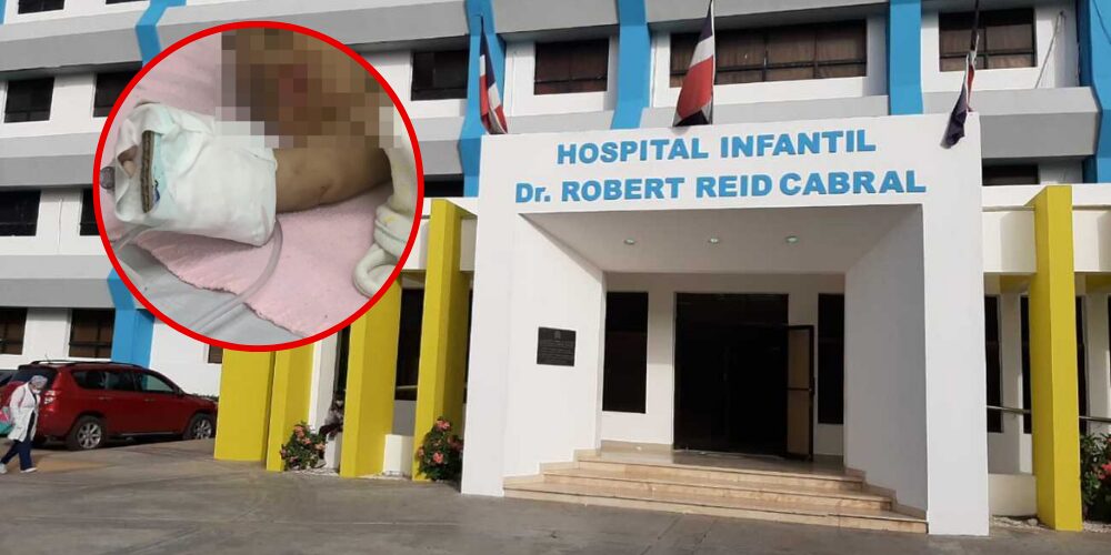 Una bebé de un mes de nacida fue ingresada al hospital por fractura de cráneo; padre denuncia a la madre