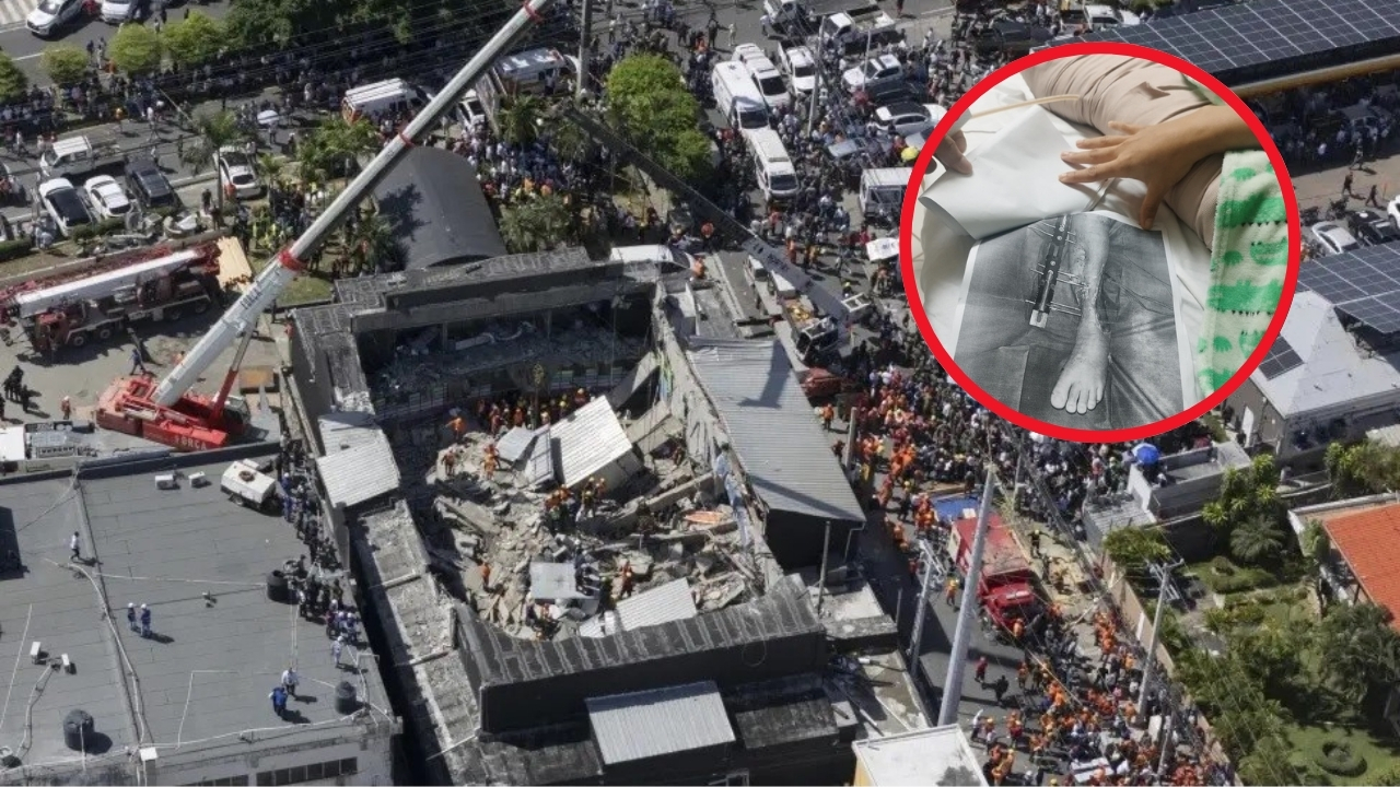 Sobreviviente del Jet Set denuncia que Senasa no cubre insumos clave para su recuperación tras tragedia