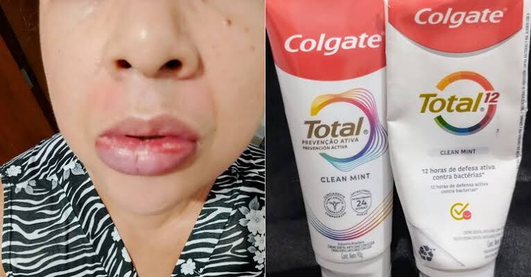 DIGEMAPS alerta sobre pasta dental Colgate Total Clean Mint con presencia de Fluoruro de Estaño - Noticias de hoy en República Dominicana | De Último Minuto